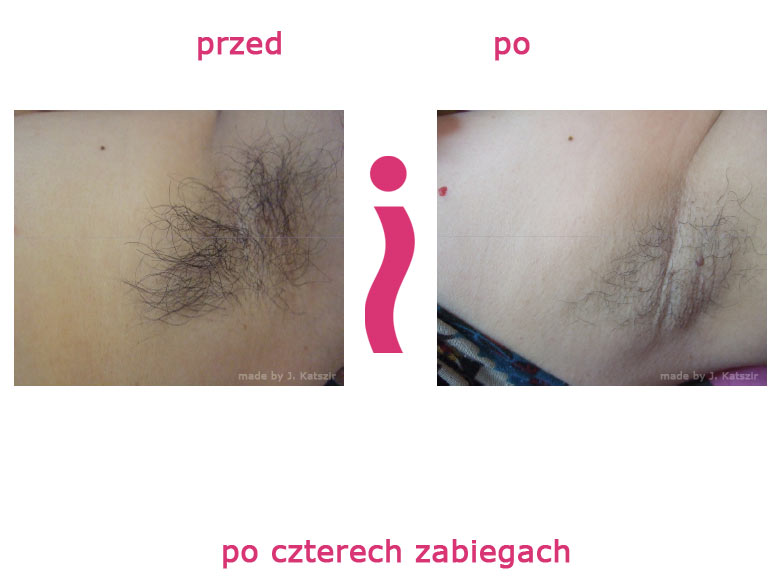 przed-i-po-pacha